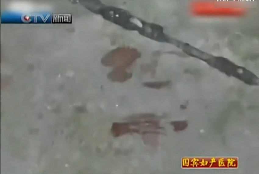 重庆<em>一女孩电梯里摔打1岁半男童</em> 疑将其扔下2