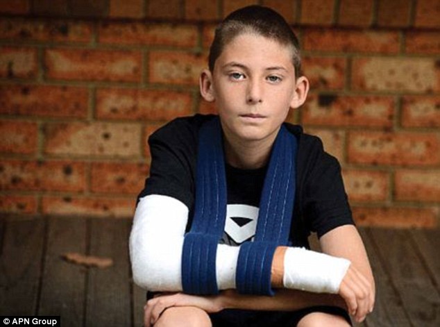 澳大利亚一少年校足球赛中胳膊摔弯变形 校方