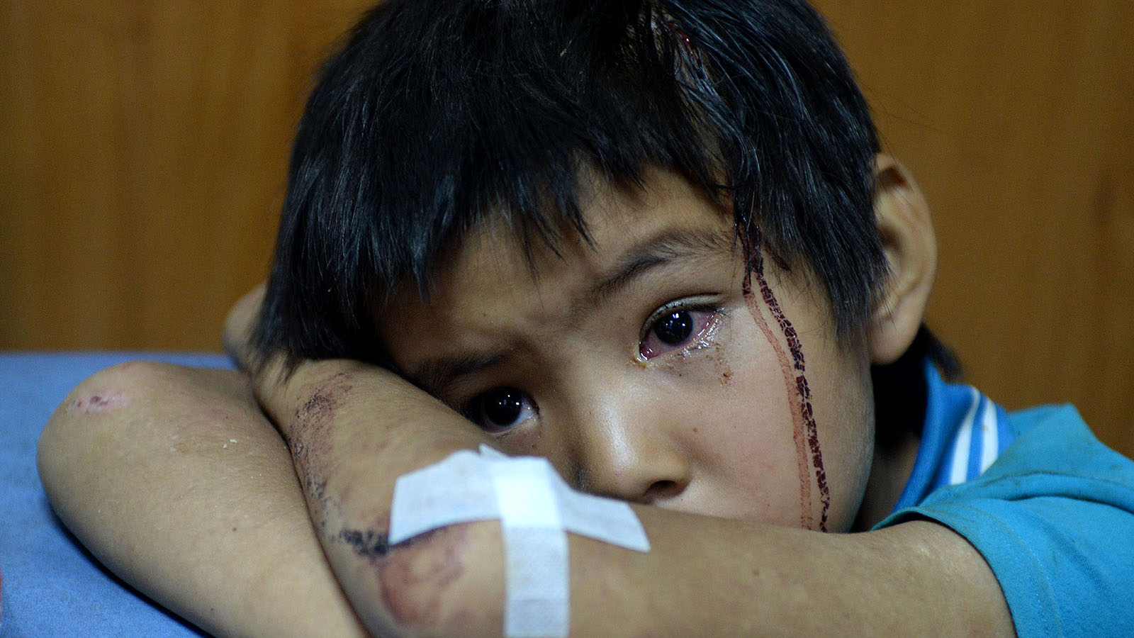 8月3日深夜，一名孩子在鲁甸县人民医院接受医治。新华社记者胡超摄