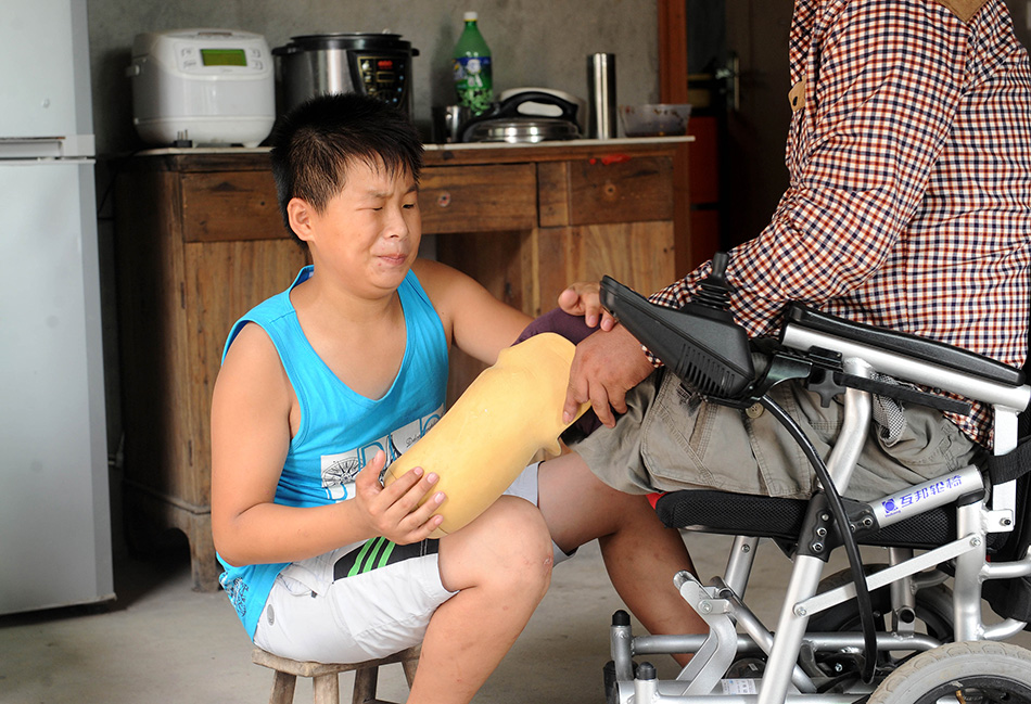 8月11日，徐佳浩在帮助父亲套上假肢。
