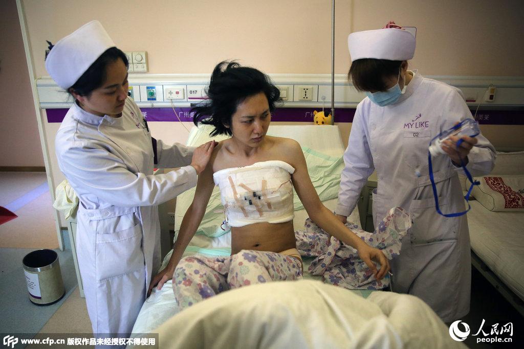 道德模范刘婷变性手术过程曝光隆胸变女人