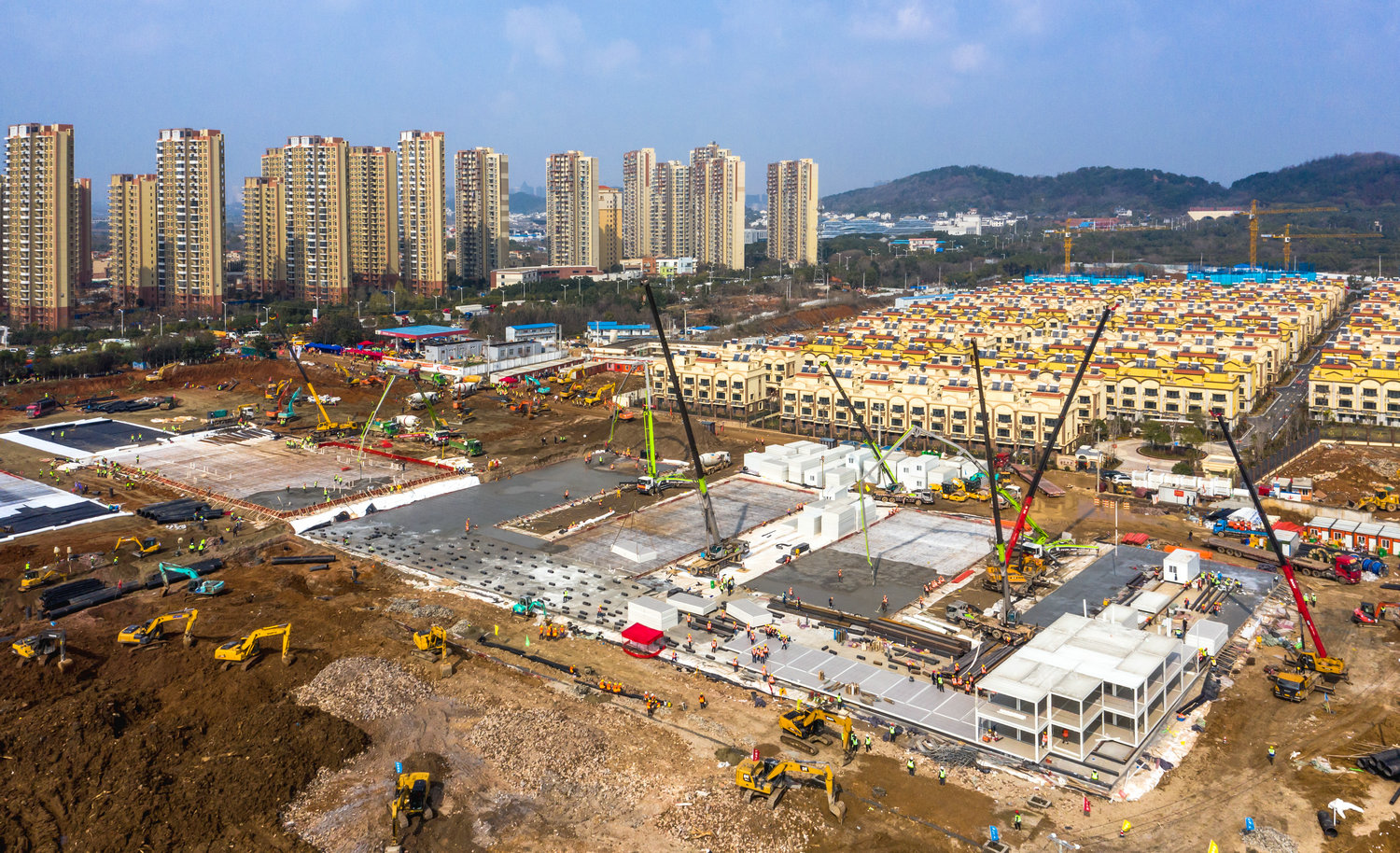 10.1��28�գ�������ģ�����ɽҽԺ�ֽṹ˫�㲡�����߹�ģ��������Ӱ