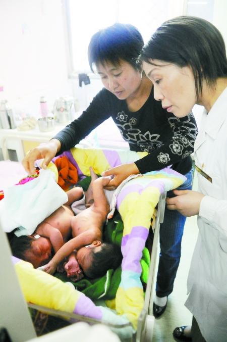 河南周口连体婴儿来郑州寻求分身术