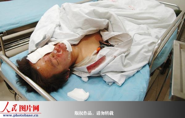 组图:苏州一饭店发生煤气爆炸 2人受伤 (3)