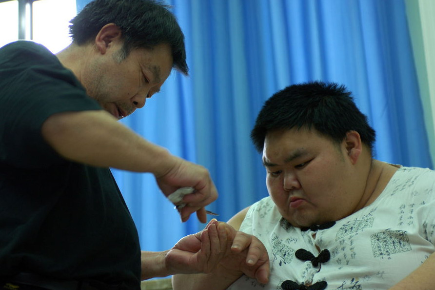 图片故事:中国第一胖梁用住院记 (9)