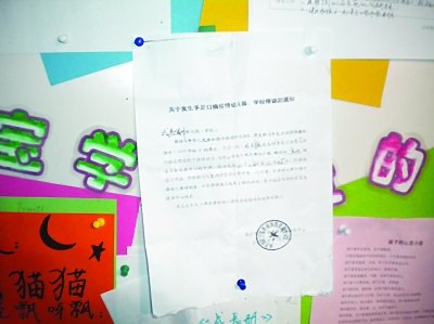 南京一幼儿园发生6例手足口病 部分班级停课