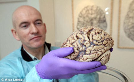 英国私人艺廊首次展出人脑 被批亵渎尊严